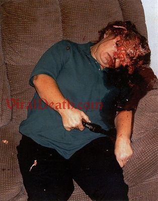 viraldeathbrainer387a.jpg