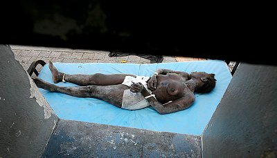 20902_earthquake-victims-23-haiti-jan-2010-20b.jpg