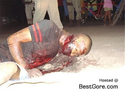 neck-wound-machete-posto-brazil-01-500x375.jpg