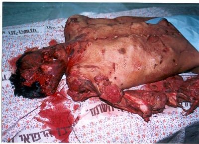 suture02a.jpg