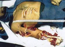 shark_attack_250183.jpg