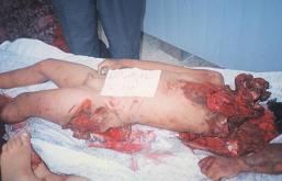 pal_jenin_mutilated-20body_jpg_44.jpg