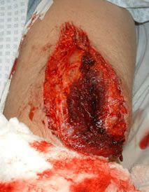 Cut-Leg-2.jpg