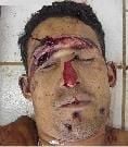 12587-brutal-man-hacked-to-death1.jpg