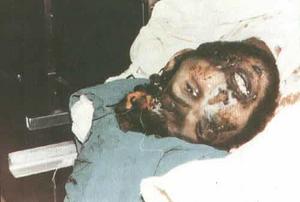 Tortured_to_death_by_Saddam-thumb.jpg