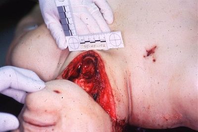 cut_my_neck_he_did_173.jpg