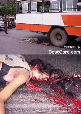 bus-accident-woman-head-crushed-eye-popped-out.jpg