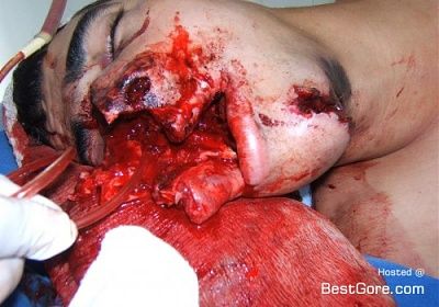 gore.jpg
