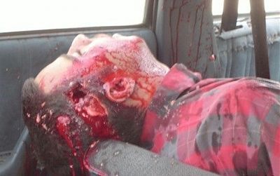 gunshot-wound-head-iraq-500x375.jpg