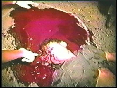 1101-horrific-aftermath-shows-man-s-brain-crushed-out-his-head.jpg