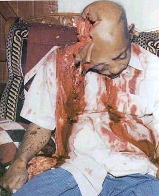 headwound1.jpg