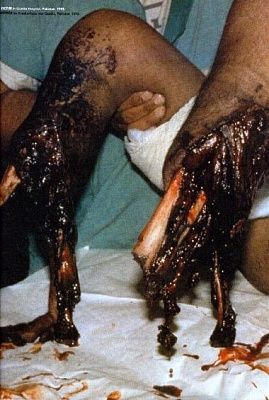 dog_bones.jpg