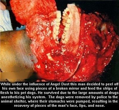 meth-addict-peels-face-feed-dogs.jpg