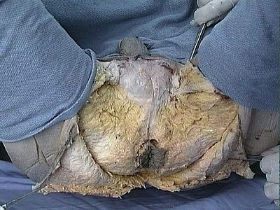 9493cadaver.jpg