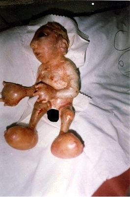 du-baby-afghanistan-3.jpg