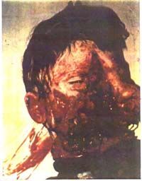 Injury3.jpg