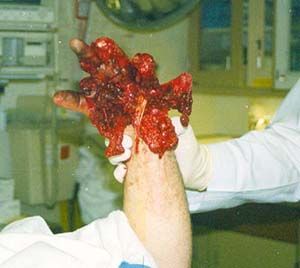 injury11.jpg