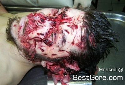 multiple-stab-wounds-face-500x343.jpg