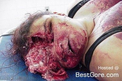 fat-woman-brain-leak-head-blast-01-500x332.jpg