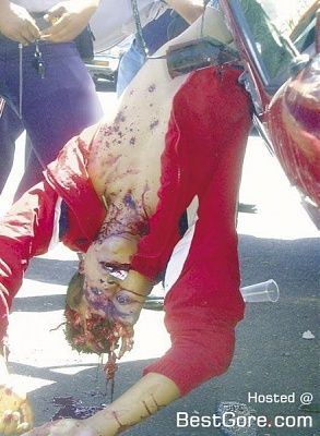head-crushed-accident-01-440x600.jpg