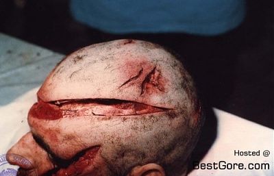 axe-head-murder-01-500x321.jpg