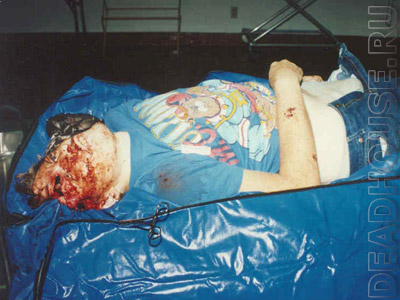Name:  suicide_10_02-640x480.jpg
Views: 108
Size:  115.6 KB