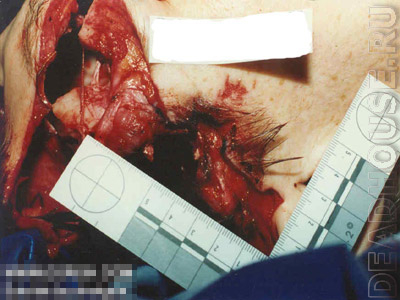 Name:  suicide_10_05-640x480.jpg
Views: 107
Size:  107.9 KB