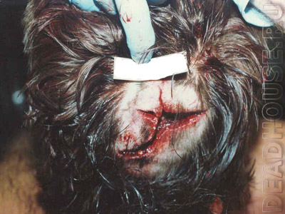 Name:  suicide_10_06-640x480.jpg
Views: 103
Size:  120.8 KB