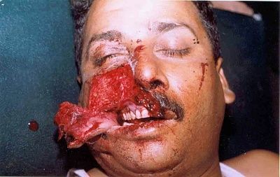 skin_pre1.jpg