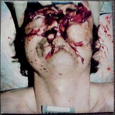 shotgun-suicide-1.jpg