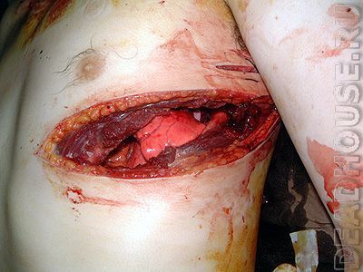attached-file-3.jpg