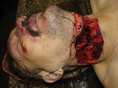 12953-high-quality-photo-throat-cut-broken-bottlebig0.jpg