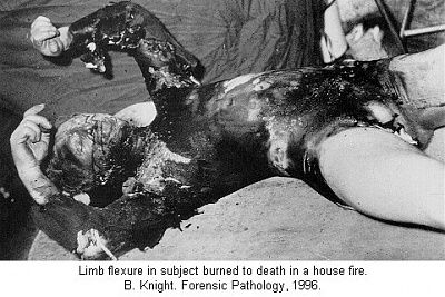 pic-ac-burn06.jpg