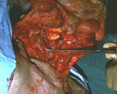pic-other-operace08.jpg