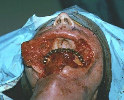 pic-other-operace04.jpg