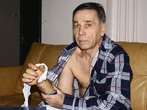 12975-anyone-missing-a-hand...amazing-reattachment-surgery-includedbig1.jpg