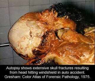 festered_morgue079.jpg