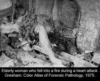 festered_morgue078.jpg