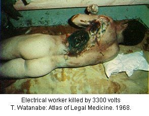 festered_morgue109.jpg