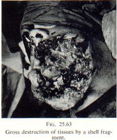 festered_gunsho001.jpg