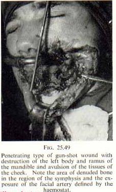 festered_gunsho007.jpg