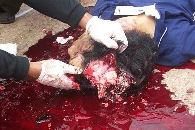 12829-chinaman-blasted-two-cars..head-split-wide-openbig0.jpg