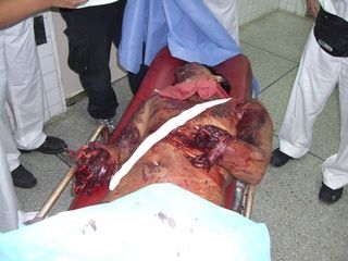 granat1.jpg
