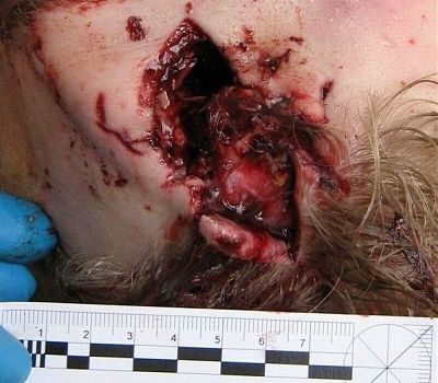 suicid_141009_1.jpg