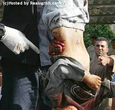 Kid with Guts Spilled Out of His Back is Hanging Upside Down.jpg