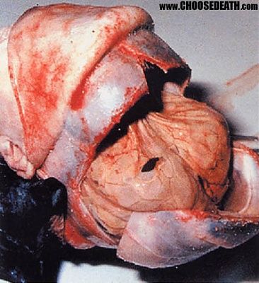 patho67d.jpg