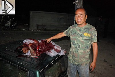 bloody-20with-20a-20pointer-20-285-29.jpg