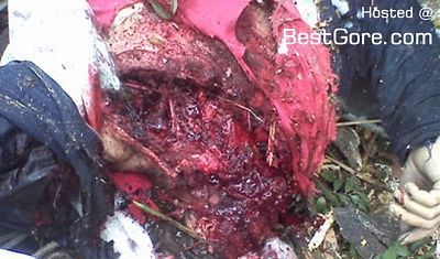 truck-driver-ejected-head-trauma-03.jpg