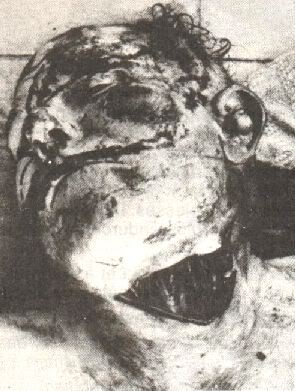 throat10.jpg