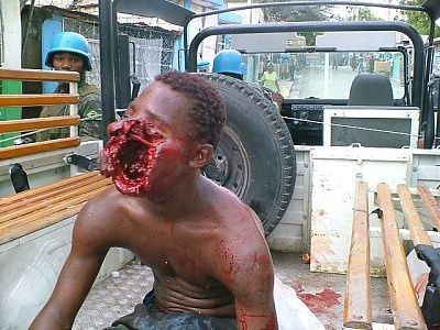 11812-gunshot-makes-guys-face-explodebig0.jpg